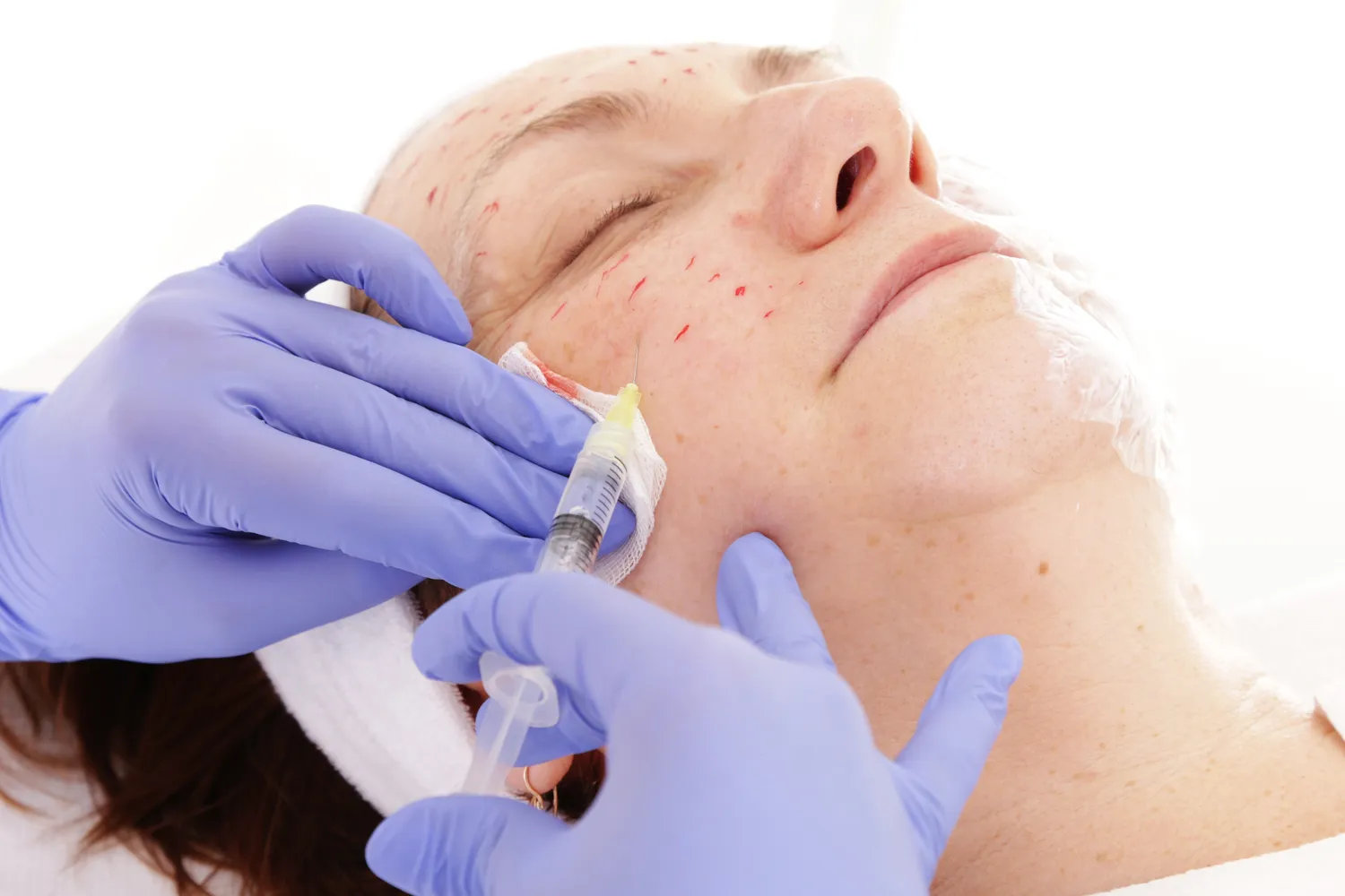 Medycyna estetyczna po co?